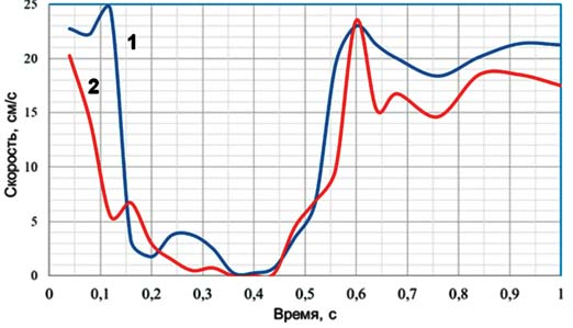 Рис. 4. Оценка линейной скорости распространения контраста в ПМЖВ (1) и ДВ (2) левой коронарной артерии.